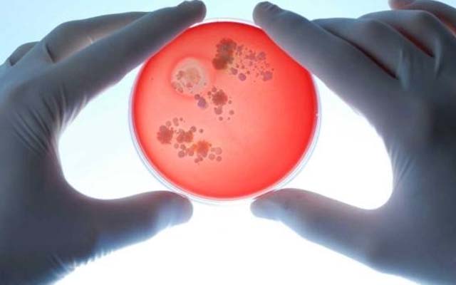 農(nóng)用微生物菌劑里的微生物說的是什么